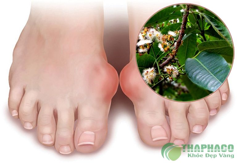 Cách chữa bệnh gout bằng lá vối tươi có tốt không?