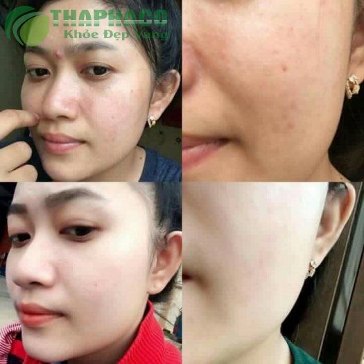 Bột tắm trắng kiều beautyqueen Mới 100%, giá: 160.000đ, gọi: 0948783508, Đà  Lạt - Lâm Đồng, id-b6830900
